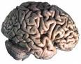 Neurologie